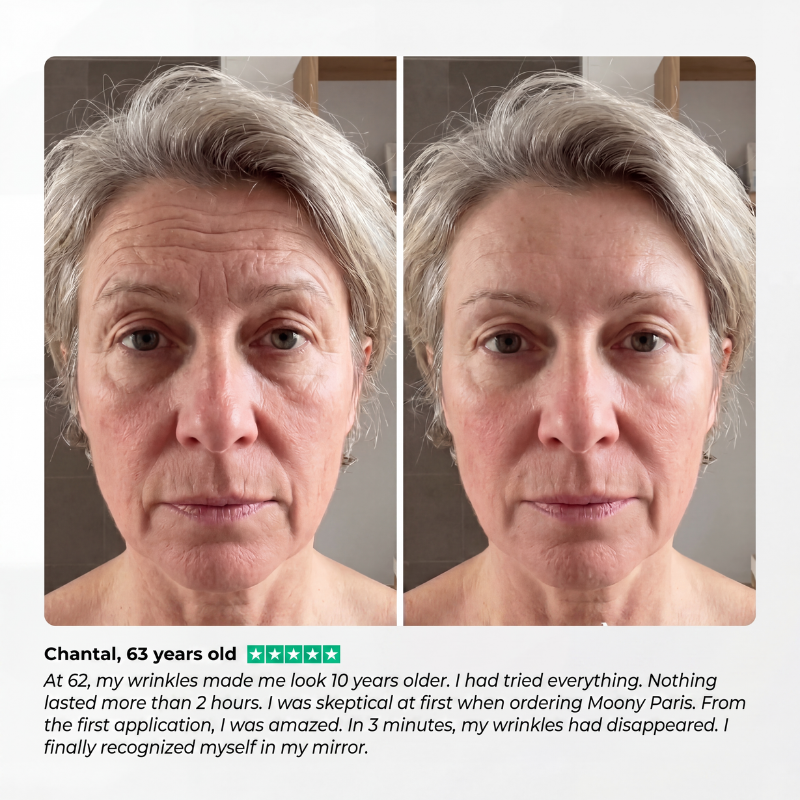 Moony™ - Instant Wrinkle Smoother