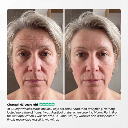Moony™ - Instant Wrinkle Smoother