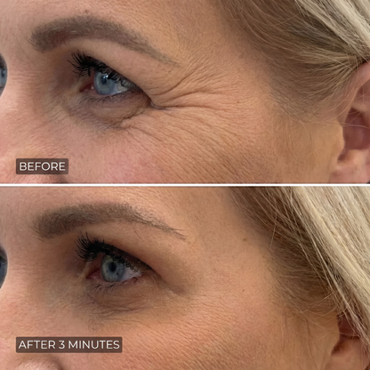 Moony™ - Instant Wrinkle Smoother