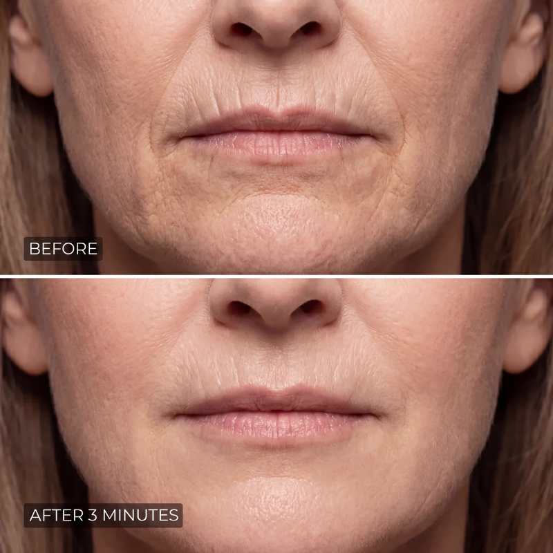 Moony™ - Instant Wrinkle Smoother