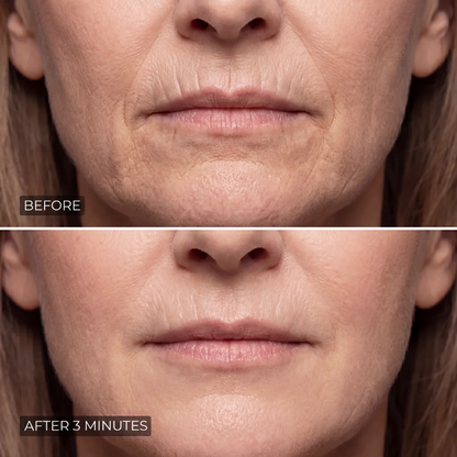 Moony™ - Instant Wrinkle Smoother