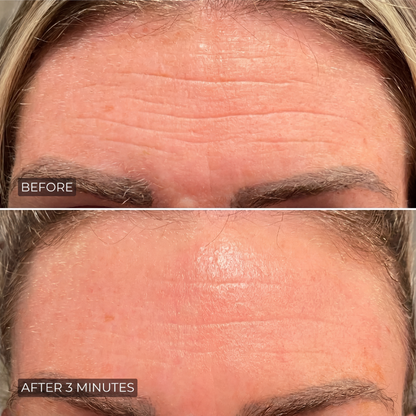 Moony™ - Instant Wrinkle Smoother